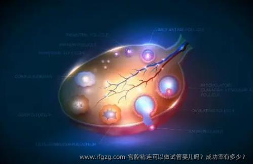 宫腔粘连可以做代孕吗？成功率有多少？