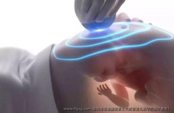 如何降低泰国做第三代代孕助孕的医疗费用？