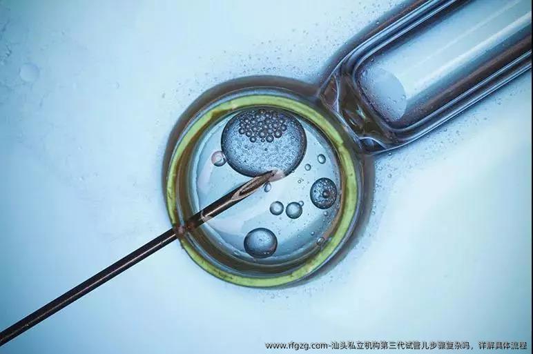 汕头私立机构第三代试管儿步骤复杂吗，详解具体流程
