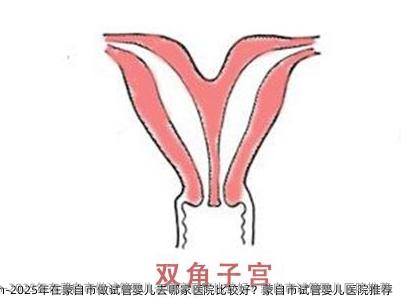 2025年在蒙自市做代孕去哪家医院比较好？蒙自市代孕医院推荐